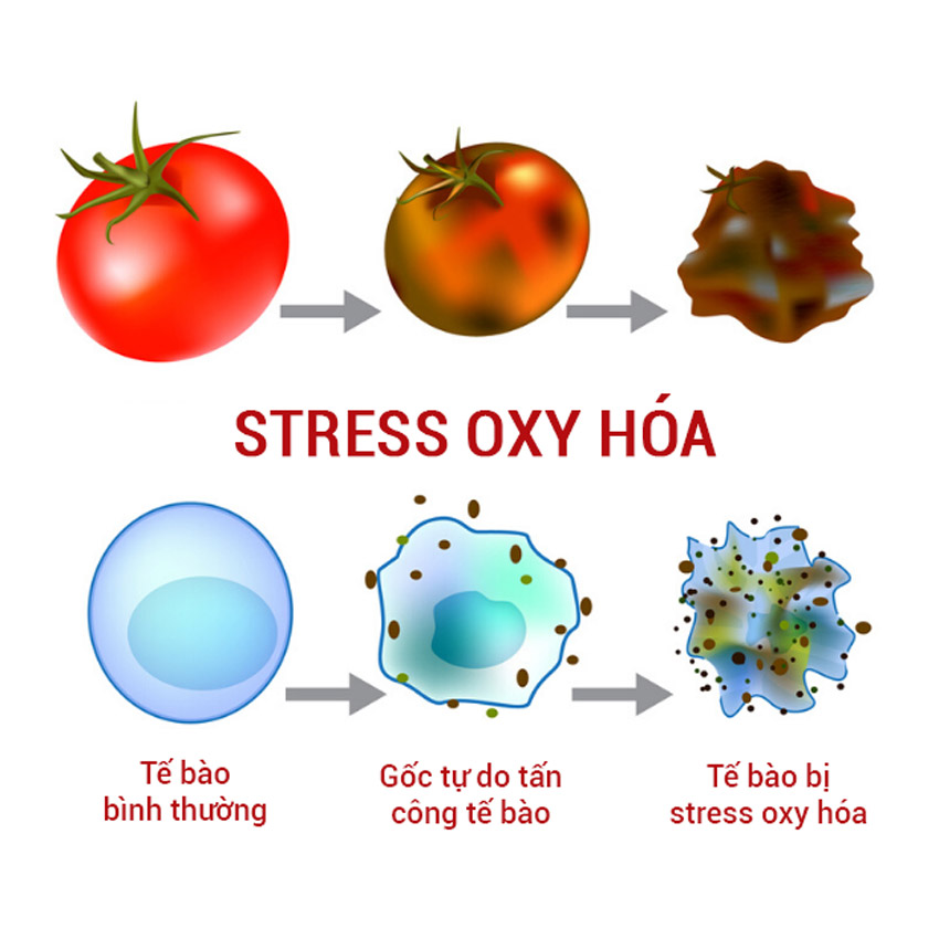 Oxidative Stress (Stress Oxi hóa) là gì?